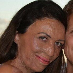 Turia Pitt Profile Picture