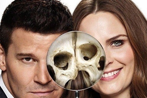 Bones