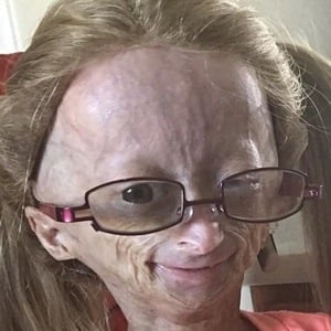 Adalia Rose at age 10