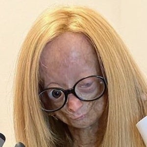 Adalia Rose at age 13