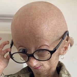 Adalia Rose at age 13