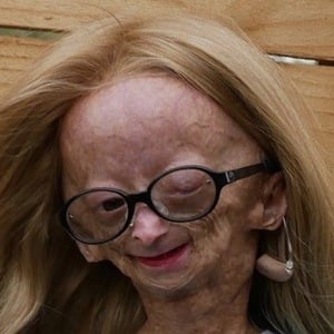 Adalia Rose at age 13