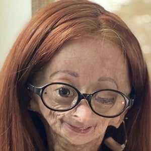 Adalia Rose at age 13