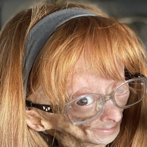 Adalia Rose at age 14