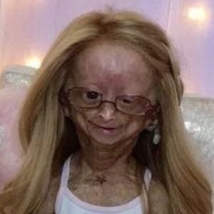 Adalia Rose at age 10