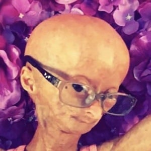 Adalia Rose at age 12