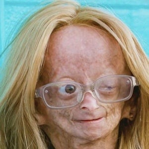 Adalia Rose at age 12