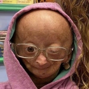 Adalia Rose at age 12