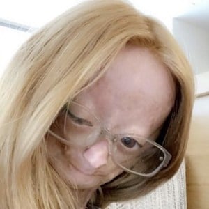 Adalia Rose at age 12