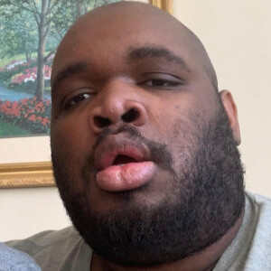 RexTestarossa at age 28