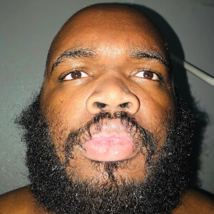 RexTestarossa at age 27