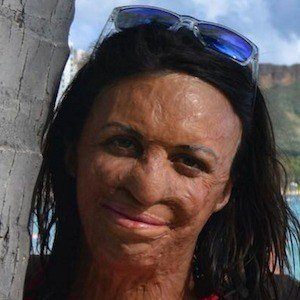 Turia Pitt Headshot 2 of 3