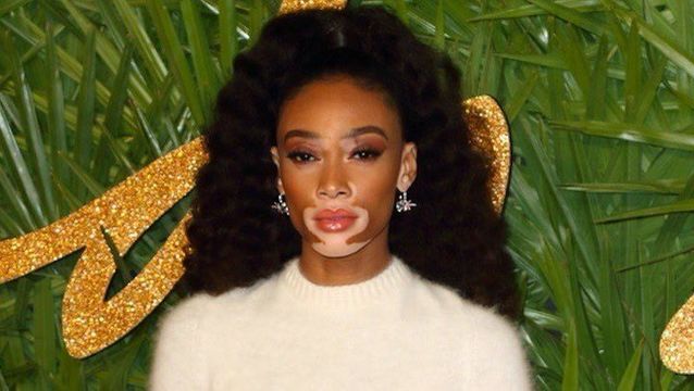 Winnie Harlow Highlights